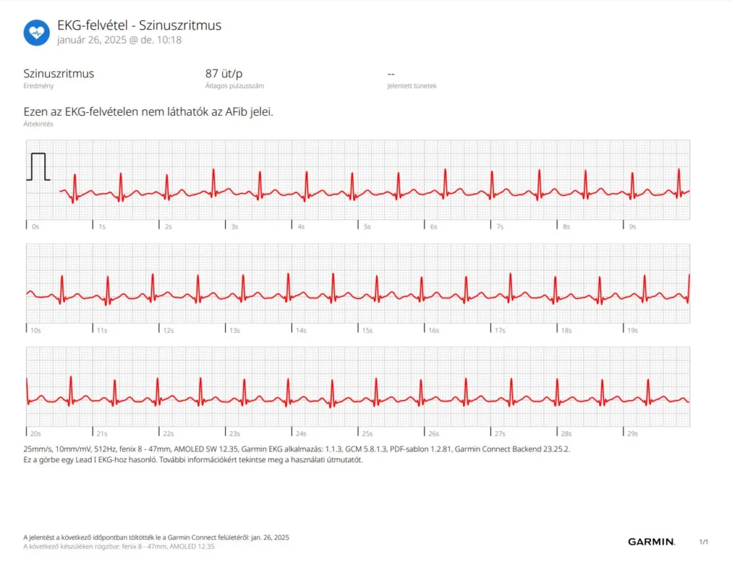 EKG – mi látszik egy kétpontos mérésből?