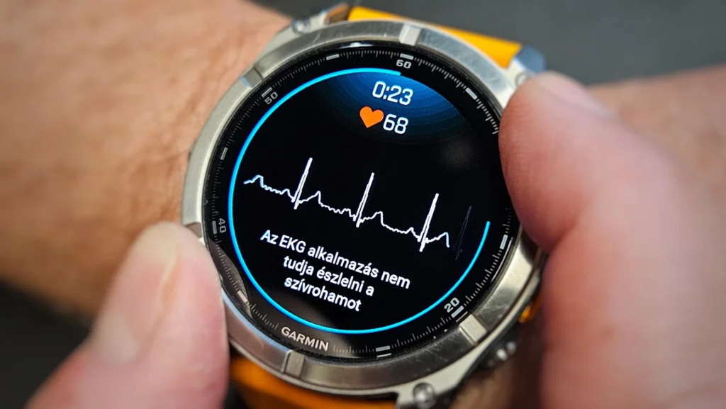 EKG mérés a Garmin órákban